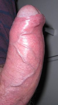 foreskin as requested!