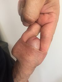 Fingering my foreskin!