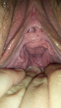Well it hurt, but he pulled me open much as we could to see in my vagina