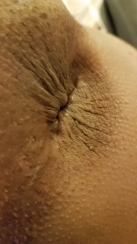 Butt*Hole