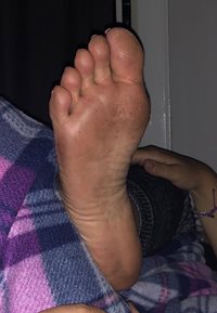 Another day barefoot. Another dirty sole