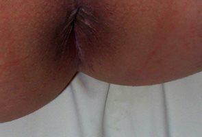 My sexy butthole the summer I was 18