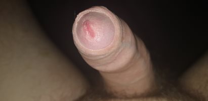 Who wants to suck on this?