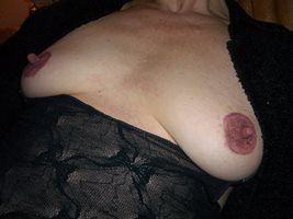 my nipples