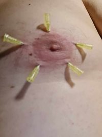 needles in chest