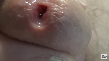 part 1: Closeups of my open holes with lots of juice