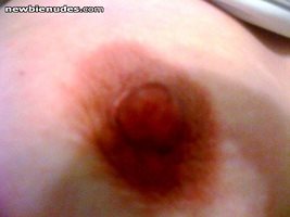 left nipple